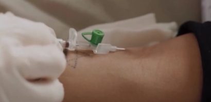 Lời cảnh báo: Nguy hiểm từ ‘trào lưu’ lọc máu ngừa đột quỵ